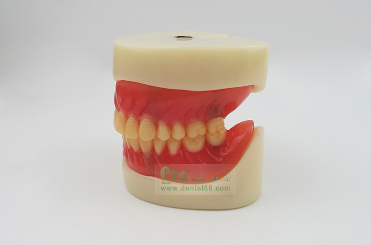 Full Denture Implant Mode